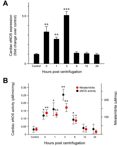 Figure 2: Effect of exposure to hypergravity on cardiac eNOS protein expression and enzymatic activity and NO production
