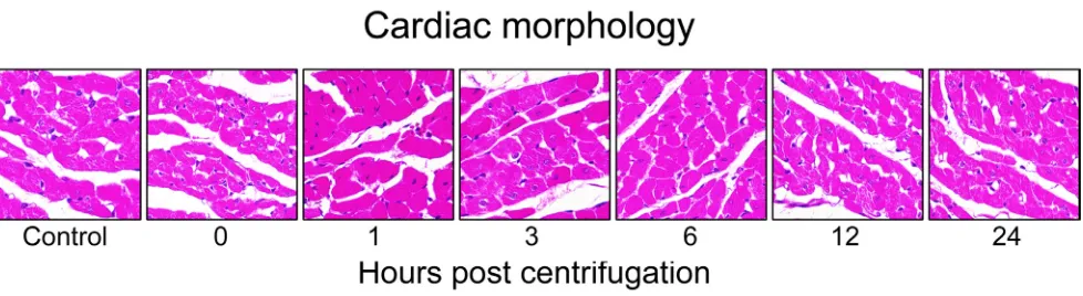 Figure 3: Representative photomicrographs of tissue sections obtained from hypergravity-exposed hearts