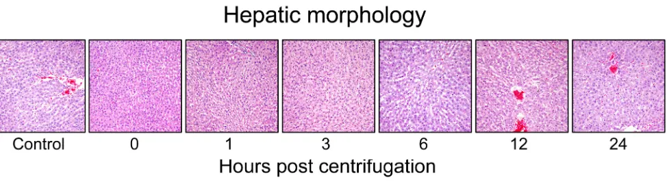 Figure 7: Representative photomicrographs of tissue sections obtained from hypergravity-exposed livers