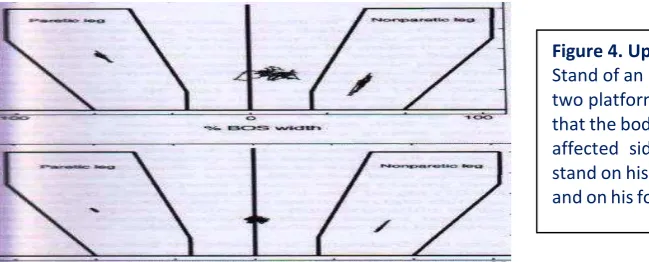 Figure 4. Upper part . 