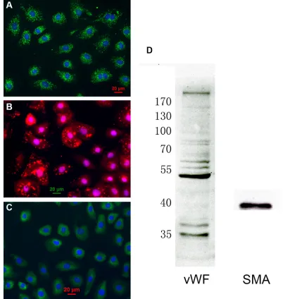 Figure 1: characterization of cardiac microvascular endothelial cells (cMEcs). (A) Cultured CMECs were immunostained for CD31 (green) and stained with DAPI for DNA (blue)