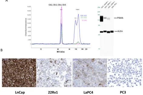 Figure 1: PSMA expression analyses of different prostate cancer cell lines (LNCaP, 22Rv1, LaPC4, and PC-3) by Western blot (A) or immunohistochemistry (B).