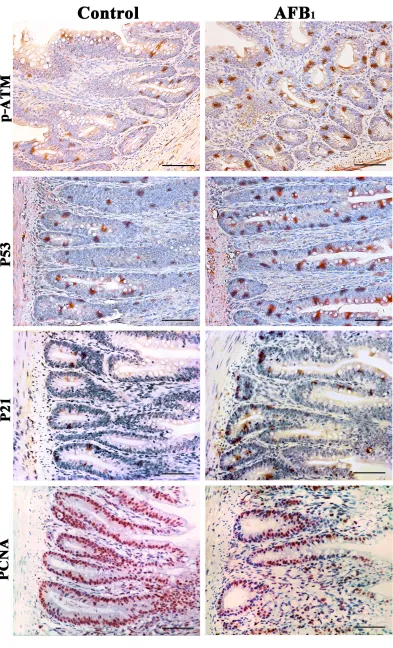 Figure 4: Expression of p-ATM, p53, p21 and PCNA protein in the jejunum at 14 days of age (Immunohistochemistry, scale bar: 50μm).