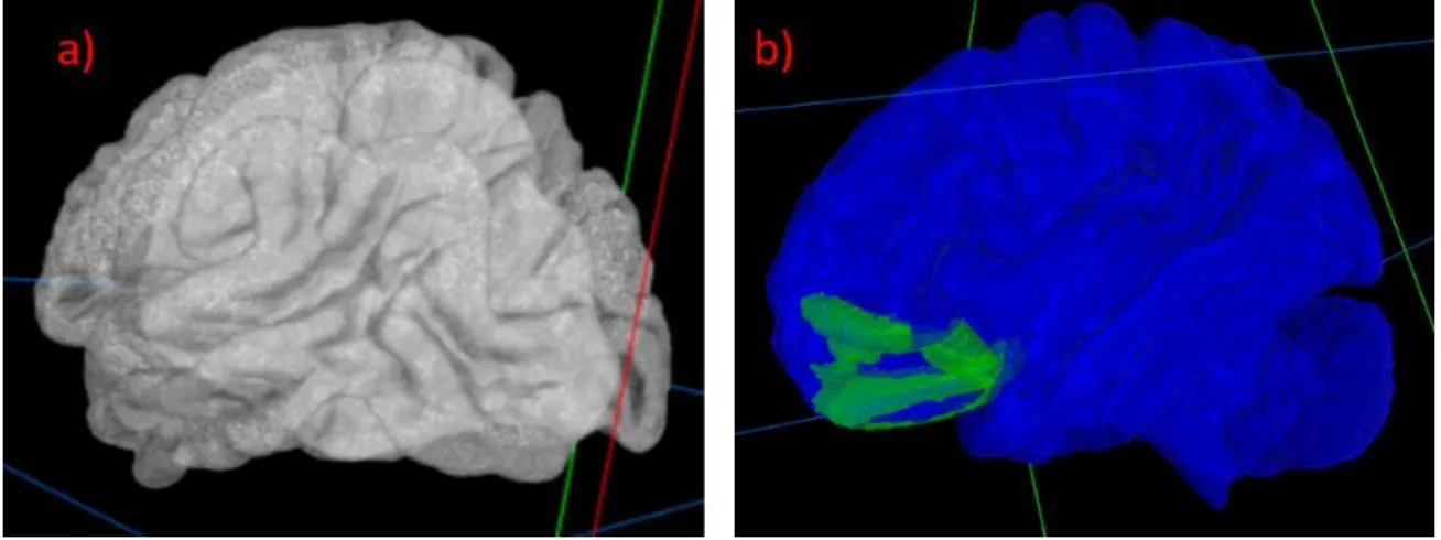 Figure 4.4: Anatomical views available in the framework. Rendering of the brain surface,  split into left and right hemispheres in (a), and rendering of all the regions of interest in the  brain, with one region highlighted in (b)