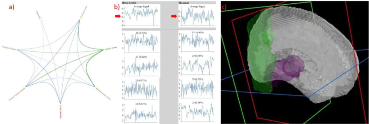 Figure 4.11: Illustration of the visual changes that take place on double selection: (a) the  edges on the radial are highlighted in two colours for the Motor Cortex and Thalamus; (b) 