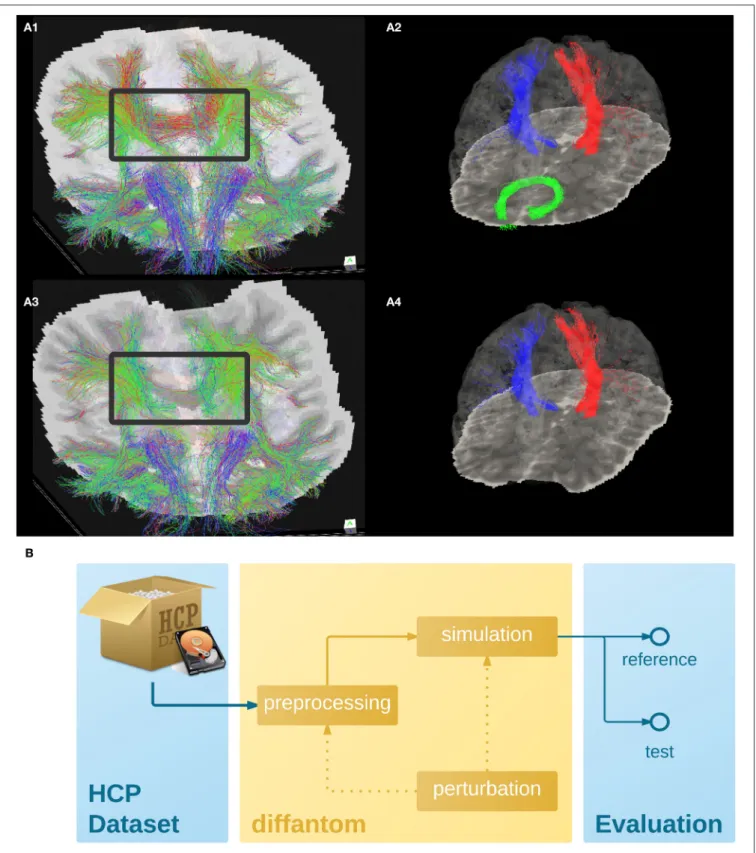 FIGURE 2 | (A) Example dataset. (A1,A3) Shows the tractogram of fibers crossing slice 56 of Diffantom as extracted with MRTrix, represented over the corresponding slice of the b0 volume for the original (A1) and the distorted (A3) phantoms, with a gray fra