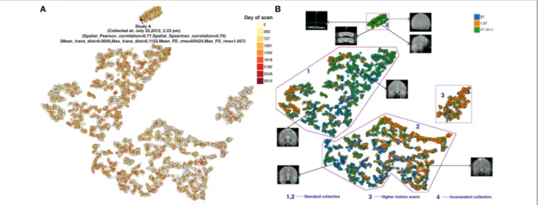 FIGURE 4 | (A) FMRI t-SNE scatter plot-color coded by (left) date of scan, and (B) (right) scanner type