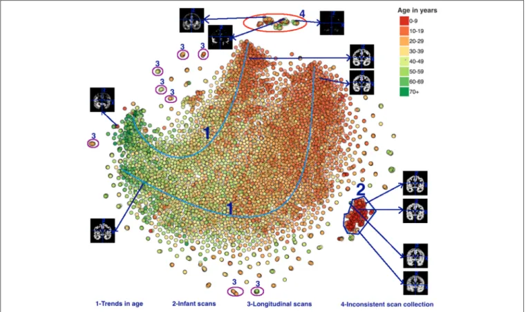 FIGURE 8 | t-SNE plot color coded by age. Groups 1–4 were visually identified and highlighted based on interesting observation and are discussed in the text.