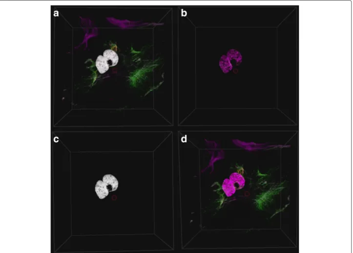 Fig. 3 Colocalization rendering methods. The colocalization can be rendered in four different ways: a Overlay the colocalized voxels as white voxels on the original volume sample