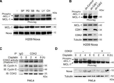 Figure 3: noxa-induced Mcl-1 phosphorylation is regulated by cdK2. (H209 SCLC cells. Cells were treated with the indicated kinase inhibitors for 4 hours and phosphorylated MCL-1 was detected on SDS-PAGE with Phos-tag