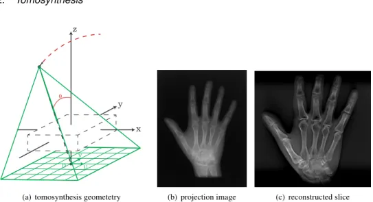 Fig. 5. In tomosynthesis, a stationary detector is placed underneath the object. The X-ray source moves on a circular trajectory above the object, creating a set of projections from a limited angle.