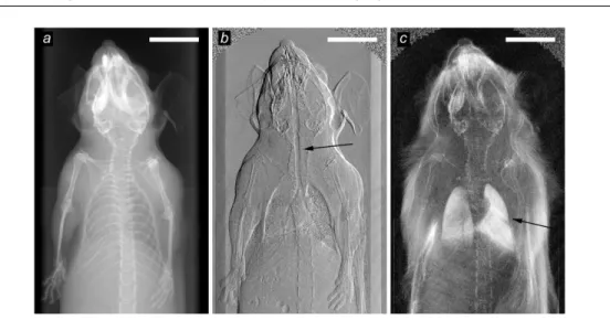 Figure 1.2: [25] (a) Conventional x-ray image based on attenuation. (b) Differential phase- phase-contrast image based on x-ray refraction