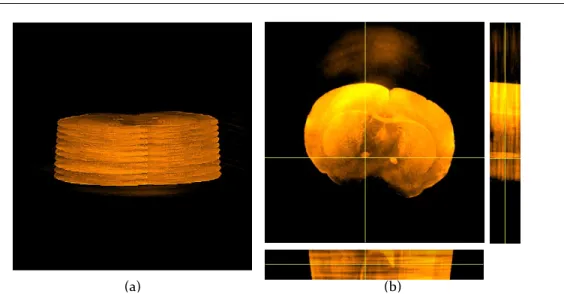 Figure 4.1: (a) In parallel-beam geometry, 3-D reconstruction is decomposed into several 2-D slice reconstruction