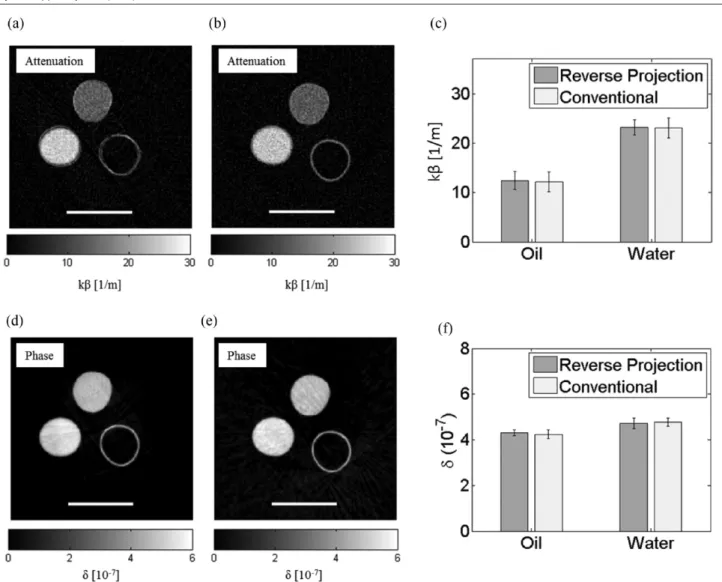 Figure 7.   Attenuation (top row) and phase (bottom row) tomograms of a custom-built phantom obtained with continuous rotation reverse  projection ((a), (d)) and stepped rotation conventional ((b), (e)) EI retrieval