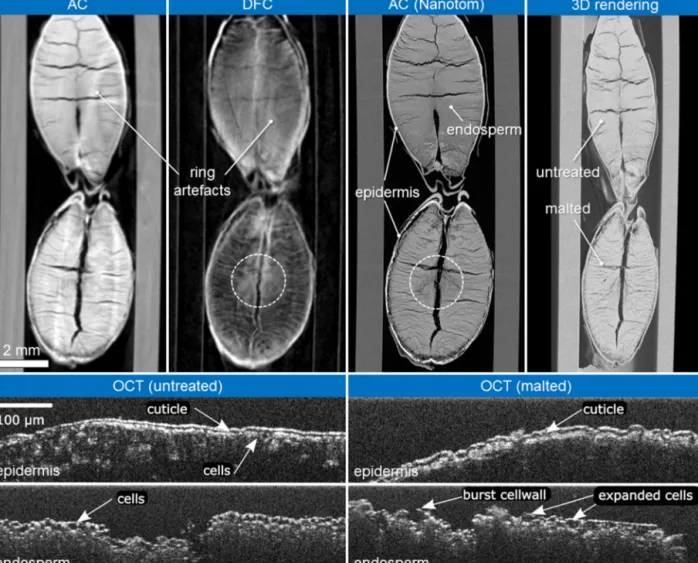 Fig. 5. μXCT results of AC and DFC (SkyScan 1294), AC (Nanotom) and its 3D rendering as wells as high-resolution OCT images showing the corn shell (epidermis) and cross-sections in the center of the cutting plane (endosperm) of an untreated and malted barl