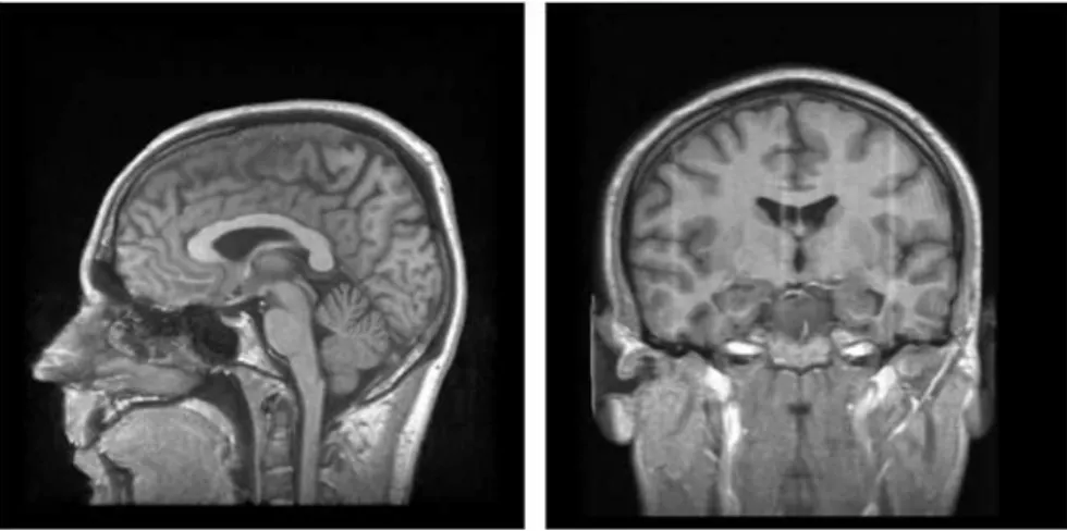 Figure 1.2   A CT scan of a human brain