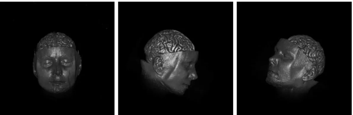 Figure 2.3 Composited images of Human Brain.