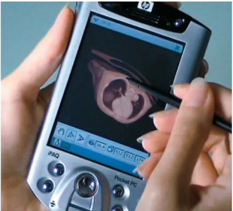 Figure 5: A volume rendered by Lamberti’s [43] technique on a PDA.