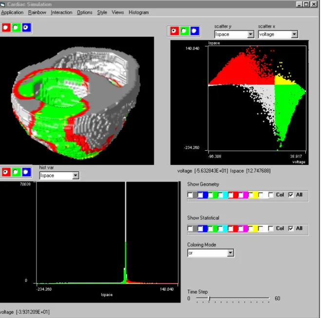 Figure 8: Exploration of cardiac data with multiple views. 3D rendering of a heart is accompanied by a scatterplot and a histogram
