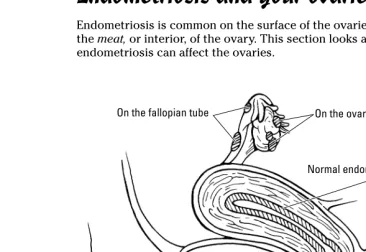 Figure 3-2:Endometri-