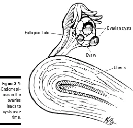 Figure 3-4:Endometri-