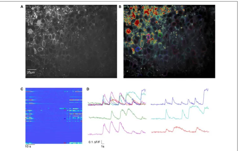 FIGURE 4 | Meso-scale imaging example for using SamuROI neuronal populations in the piriform cortex of a brain slice