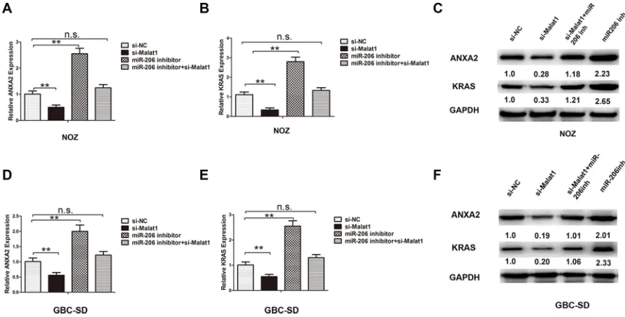 Figure 4: Knockdown of Malat1 inhibits expression of miR-206 targeting ANXA2 and KRAS