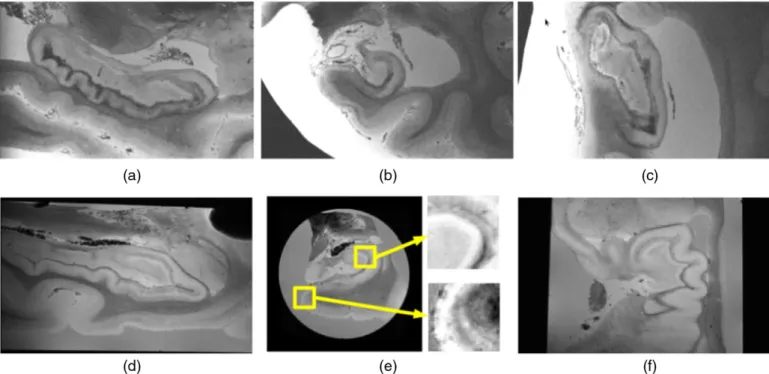 Fig. 1. Sample sagittal (a), coronal (b) and axial (c) slices from the ex vivo data of Case 8