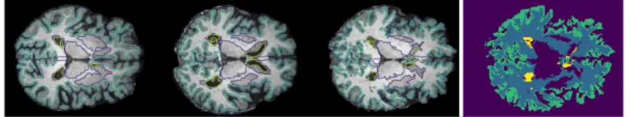 Fig. 3: A MR slice from the test set for the evaluation of the registration task for the proposed method