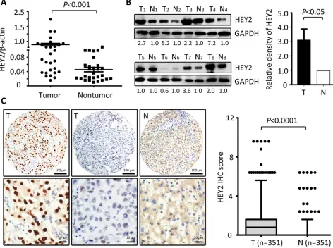 Figure 1: HEY2 expression is increased in HCC. A. The expression of HEY2 in 28 paired HCC tissues and the corresponding adjacent liver tissues was determined by qRT-PCR (Wilcoxon matched-paired test)