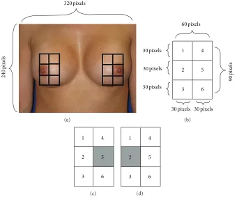 Figure 3: (a), (b) The structure of the ROI windows. (c) The sum of the pixels in 5th square must be less than others for left-nipple detection.(d) The sum of the pixels in 2nd square must be less than others for right-nipple detection.