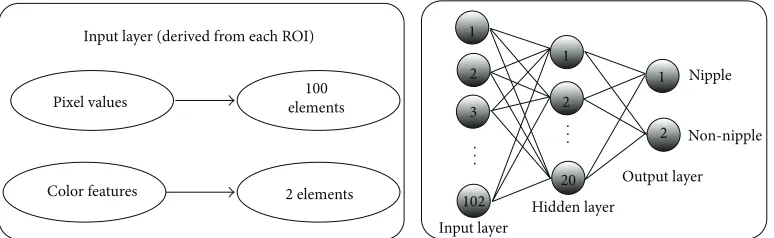 Figure 5: The samples of breast regions identification.