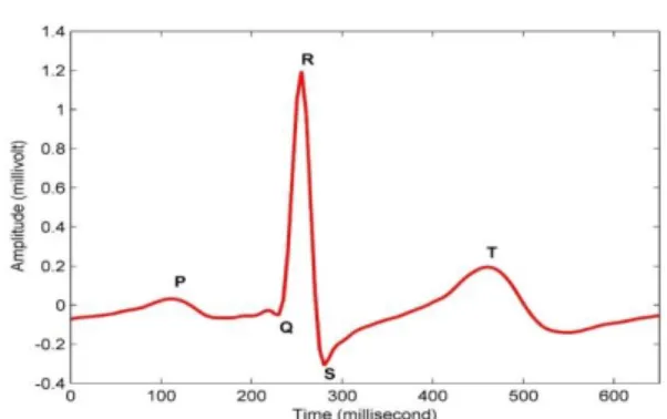 Figure 1: Waves Representation an ECG Graph 