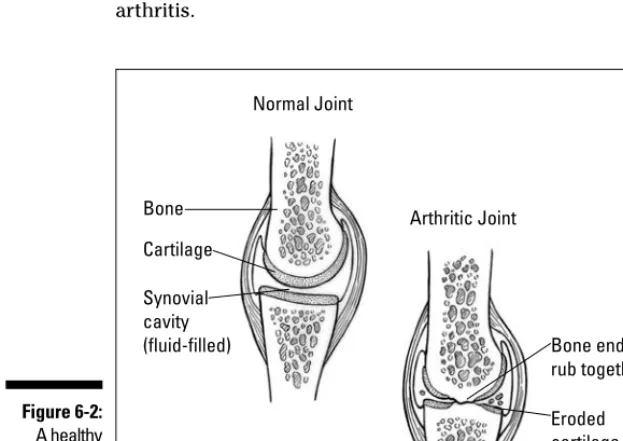 Figure 6-2:A healthy