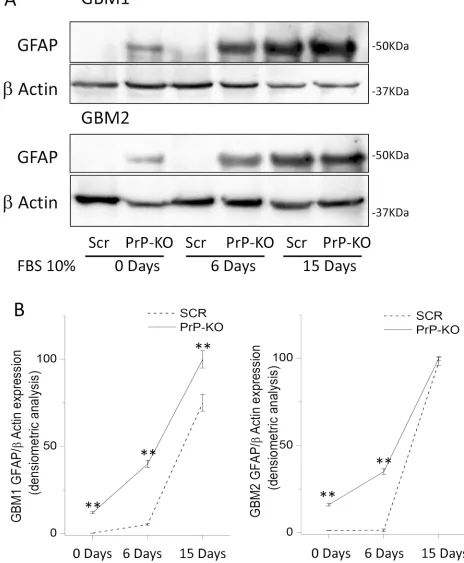 Figure 7: A. Representative immunoblots of GFAP expression in GBM-Scr and GBM-PrP-KO cells