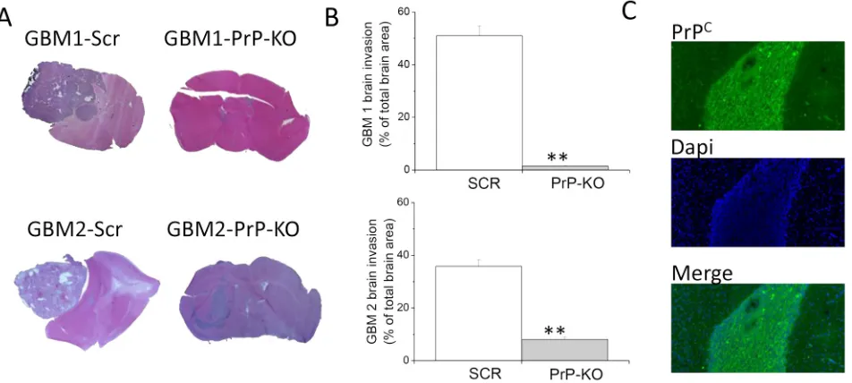 Figure 10: Role of PrPC in the in vivo tumorigenicity of human GBM CSCs. A. Representative images of tumors developed in NOD/SCID mice orthotopically grafted with GBM1- or GBM2-Scr, and GBM1- or GBM2-PrP-KO cells