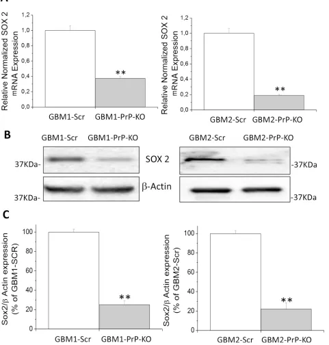 Figure 5: A. Expression of Sox2 mRNA in GBM1- and GBM2-PrP-KO cells, evaluated by quantitative RT-PCR