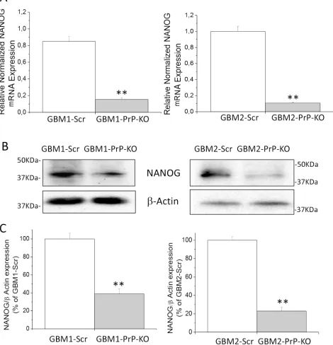 Figure 6: A. Expression of NANOG mRNA in GBM1 and GBM2-Scr and PrP-KO cells, evaluated by quantitative RT-PCR
