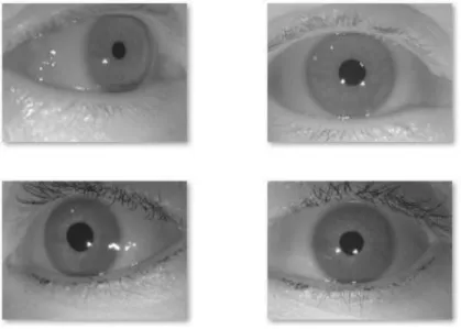 Fig 2.Examples of iris images from WVU database 