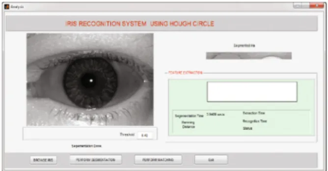 Fig. 2. GUI for circular Hough segmentation process