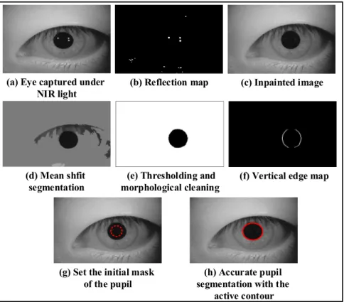 Figure 4.2: The steps of the pupillary detection algorithm for the iris images captured under near infrared light.