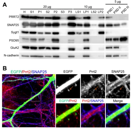 Figure 3: Localization of Prrt2 at the pre- and post-synaptic membranes. A.density (PSD) preparation of the protein from an adult rat brain