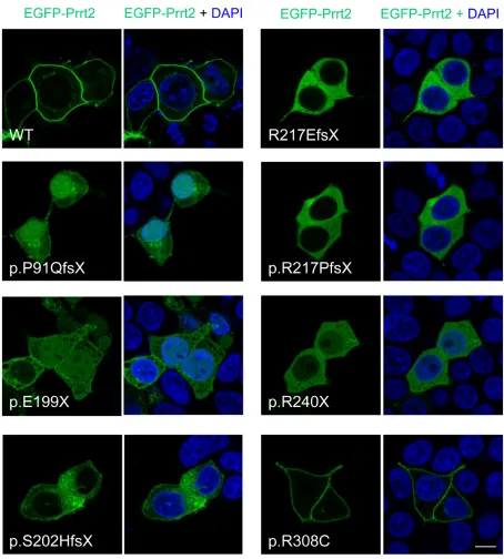 Figure 4: Subcellular localization of PKD-related PRRT2 mutations in cultured HEK293T cells
