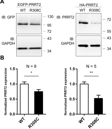 Figure 5: Reduced expression level of the R308C PRRT2 mutant. A. GFP- and HA-tagged WT-Prrt2 and the R308C mutant were transiently transfected into the HEK293T cell line