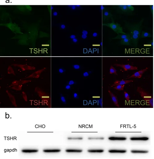 Figure 2: TSH receptor (TSHR) was expressed in neonatal rat ventricular myocytes (NRCM) and FRTL-5 cells