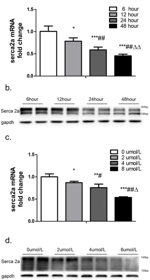 Figure 3: SERCA2a expression after treatment with different concentrations of TSH for different periods of time was measured in cardiomyocytes