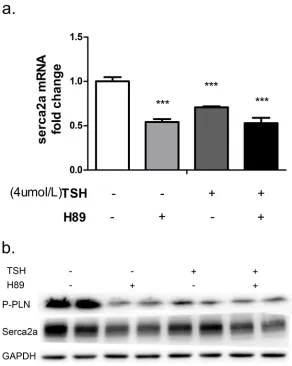 Figure 5: NRCMs were treated with 4 μM TSH and 20 μM H89 for 24 hours. Changes in PKA/PLN pathway molecules and SERCA2a were measured with real-time PCR a