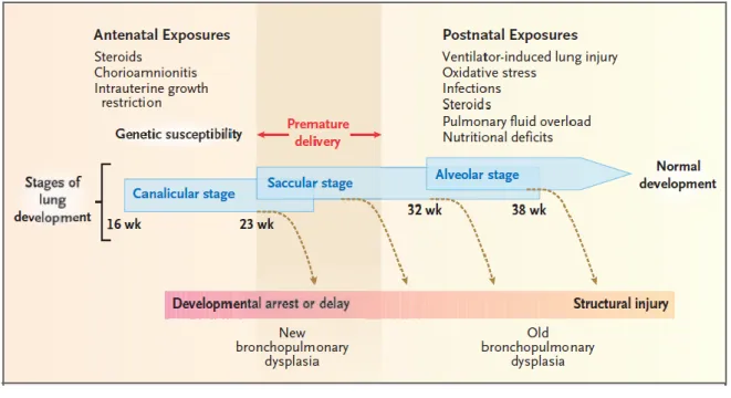 Figure 3. Schematic of the multifactorial pathogenesis of bronchopulmonary  dysplasia (BPD)