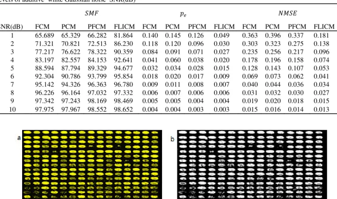 Table 1. The comparison of FCM, PCM, PFCM, FLICM  algorithm based on segmentation matching factor (ܵܯܨ),  Probability of error (݌ ௘ )  and Normalized mean square error (ܰܯܵܧ) for simulated microarray images with  different  levels of additive  white Gaussi
