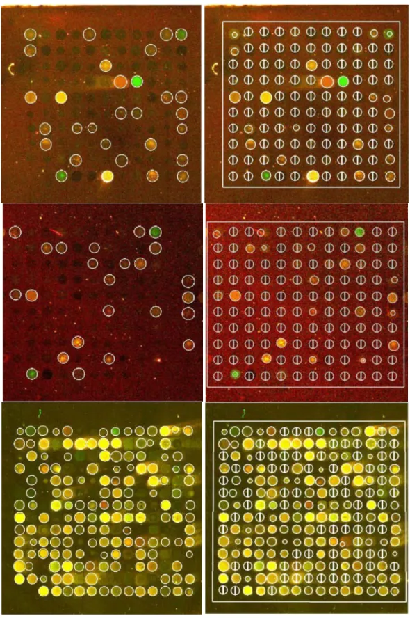 FIGURE 9. DNA Microarray spot segmentation results. Left: Proposed method. Right: GenePix Pro  V3.0, where a circle with a vertical bar across it signifies that spot is not found at that location